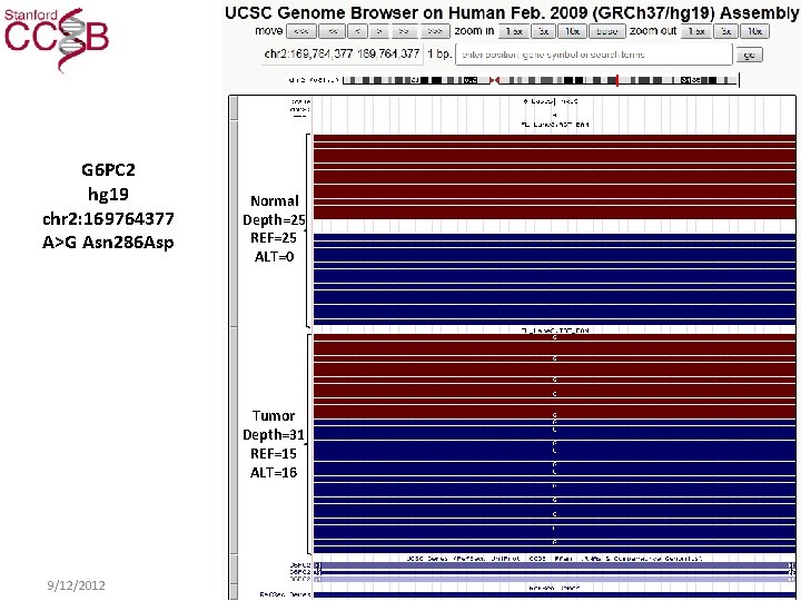 G 6 PC 2 hg 19 chr 2: 169764377 A>G Asn 286 Asp Normal