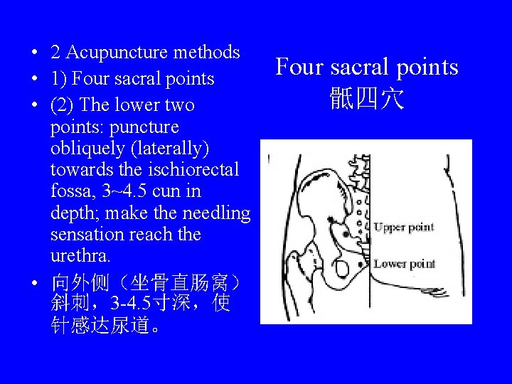  • 2 Acupuncture methods • 1) Four sacral points • (2) The lower