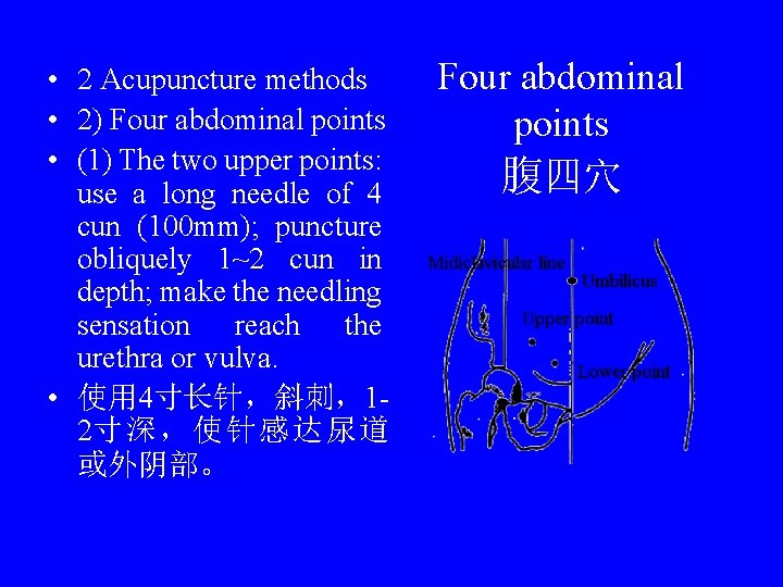  • 2 Acupuncture methods • 2) Four abdominal points • (1) The two