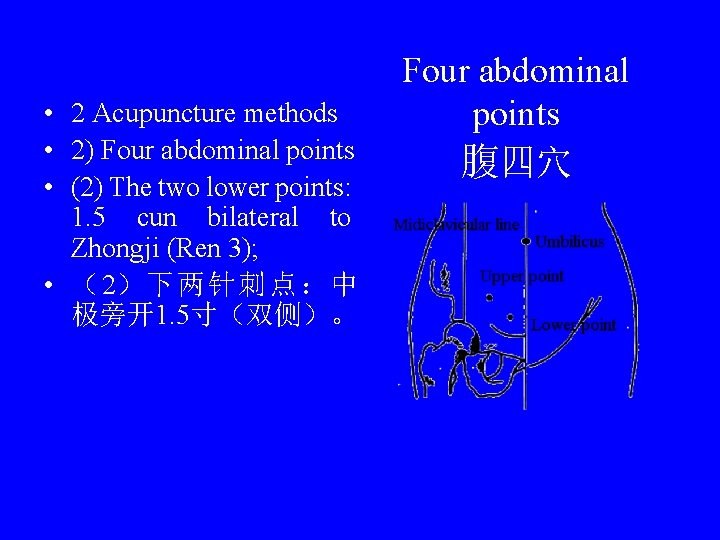  • 2 Acupuncture methods • 2) Four abdominal points • (2) The two