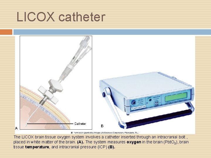 LICOX catheter The LICOX brain tissue oxygen system involves a catheter inserted through an