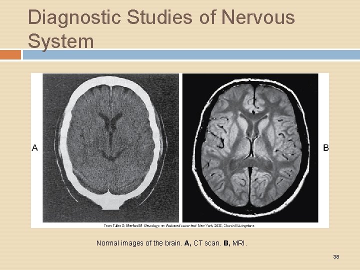 Diagnostic Studies of Nervous System Normal images of the brain. A, CT scan. B,