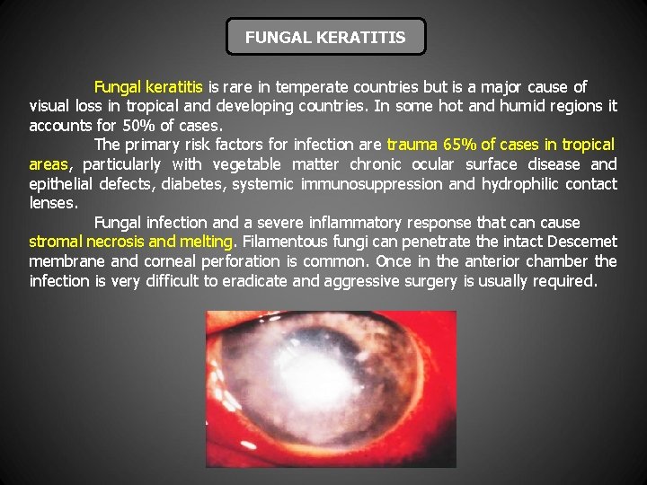 FUNGAL KERATITIS Fungal keratitis is rare in temperate countries but is a major cause