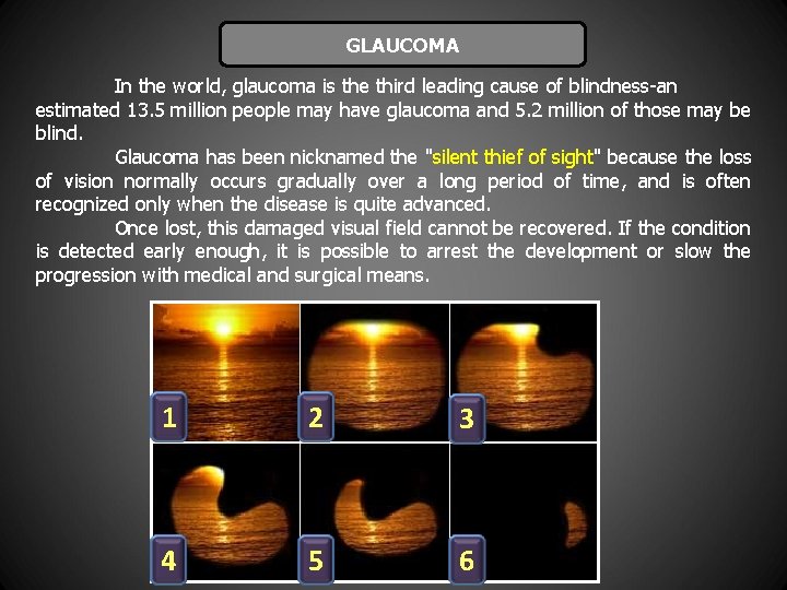 GLAUCOMA In the world, glaucoma is the third leading cause of blindness-an estimated 13.