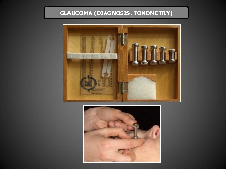 GLAUCOMA (DIAGNOSIS, TONOMETRY) 