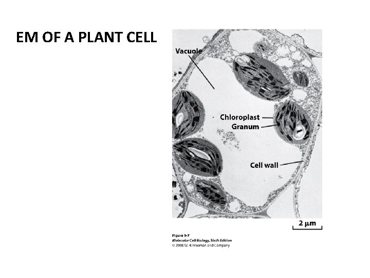 EM OF A PLANT CELL 