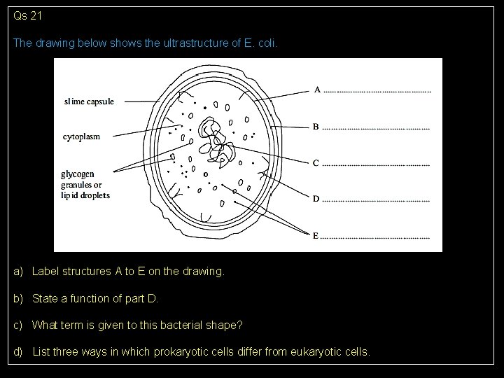 Qs 21 The drawing below shows the ultrastructure of E. coli. a) Label structures