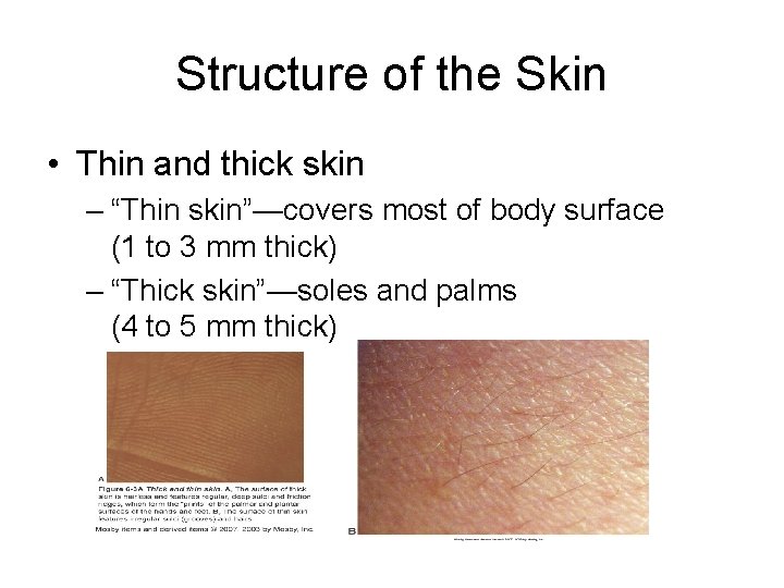 Structure of the Skin • Thin and thick skin – “Thin skin”—covers most of