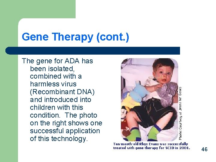 Gene Therapy (cont. ) The gene for ADA has been isolated, combined with a