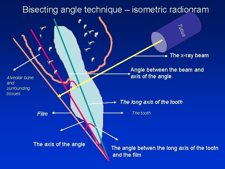 Bisecting angle technique – isometric radiogram us Tub The x-ray beam Angle between the