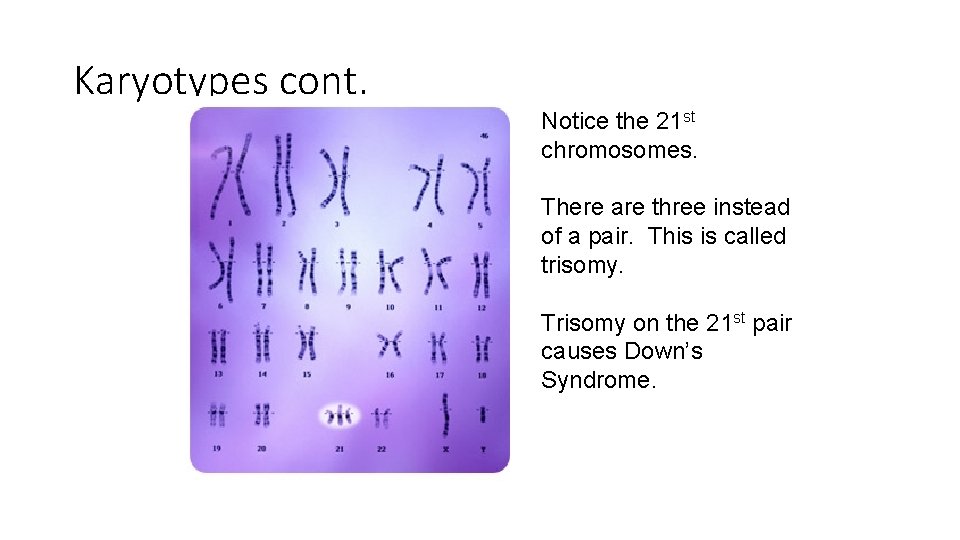 Karyotypes cont. Notice the 21 st chromosomes. There are three instead of a pair.