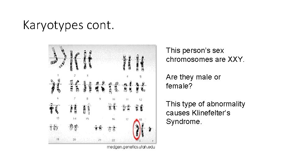 Karyotypes cont. This person’s sex chromosomes are XXY. Are they male or female? This