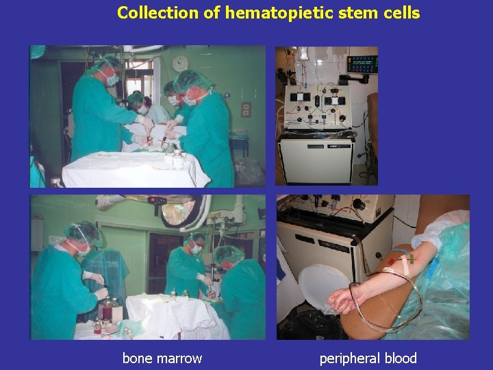 Collection of hematopietic stem cells bone marrow peripheral blood 