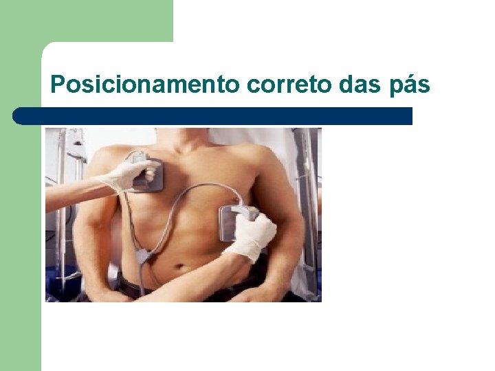 Posicionamento correto das pás 