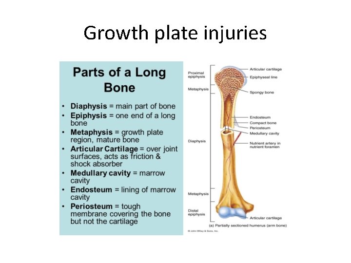 Growth plate injuries 