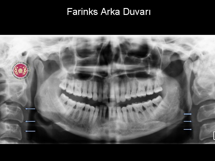 Farinks Arka Duvarı 