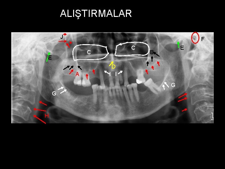 ALIŞTIRMALAR J F C C E A E B D I I G G