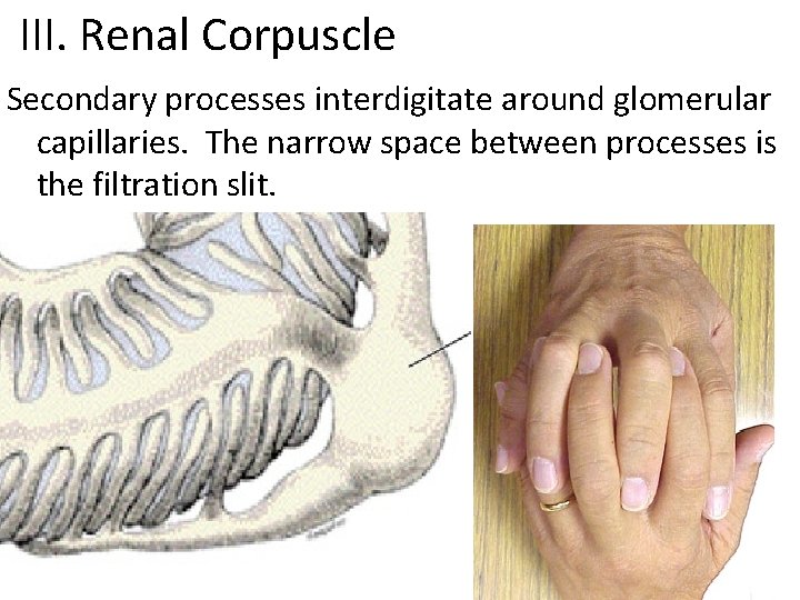  III. Renal Corpuscle Secondary processes interdigitate around glomerular capillaries. The narrow space between