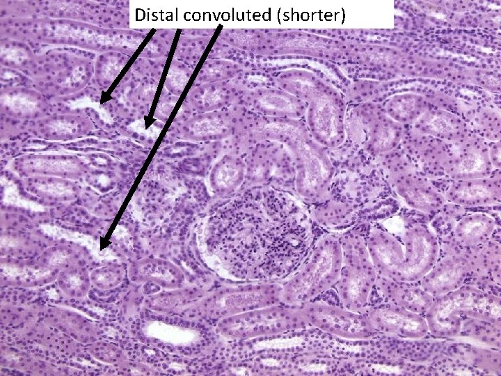 Distal convoluted (shorter) 