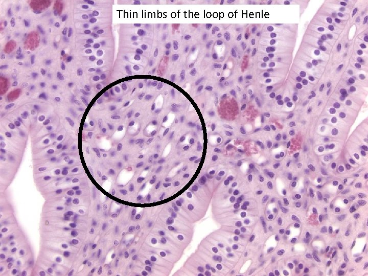 Thin limbs of the loop of Henle 