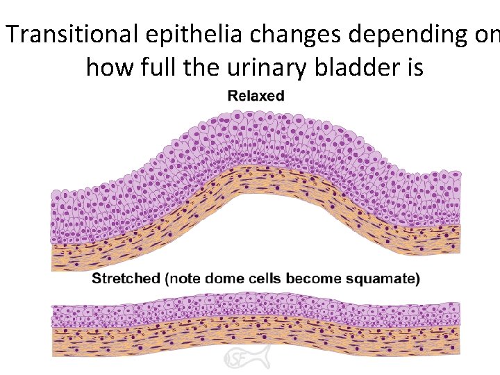 Transitional epithelia changes depending on how full the urinary bladder is 