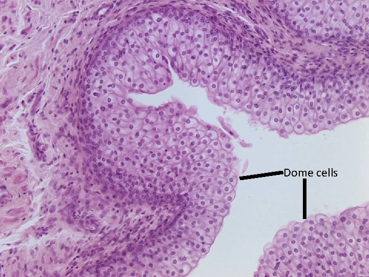 Dome cells 