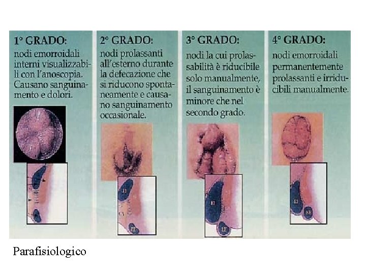Parafisiologico 