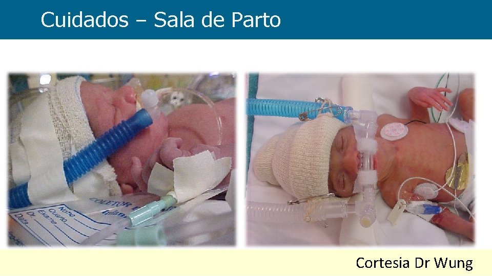 Cuidados – Sala de Parto Cortesia Dr Wung 