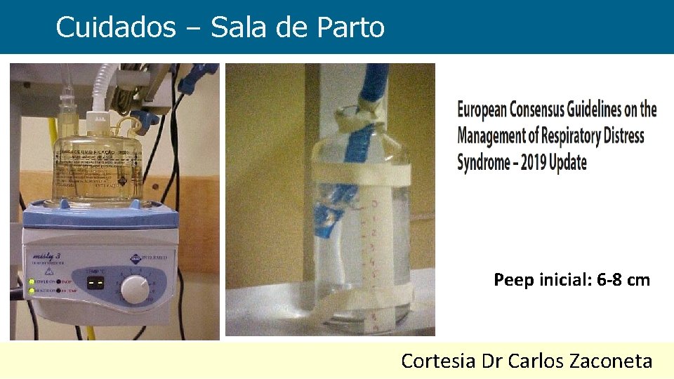 Cuidados – Sala de Parto Peep inicial: 6 -8 cm Cortesia Dr Carlos Zaconeta
