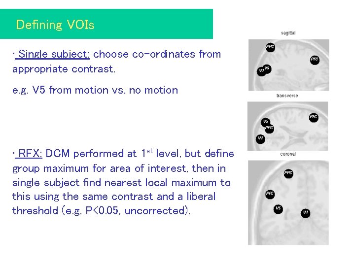 Defining VOIs • Single subject: choose co-ordinates from appropriate contrast. e. g. V 5