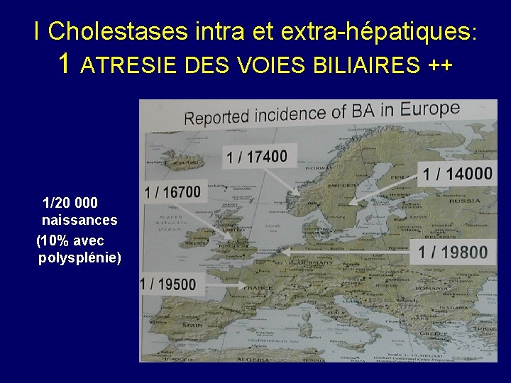 I Cholestases intra et extra-hépatiques: 1 ATRESIE DES VOIES BILIAIRES ++ 1/20 000 naissances