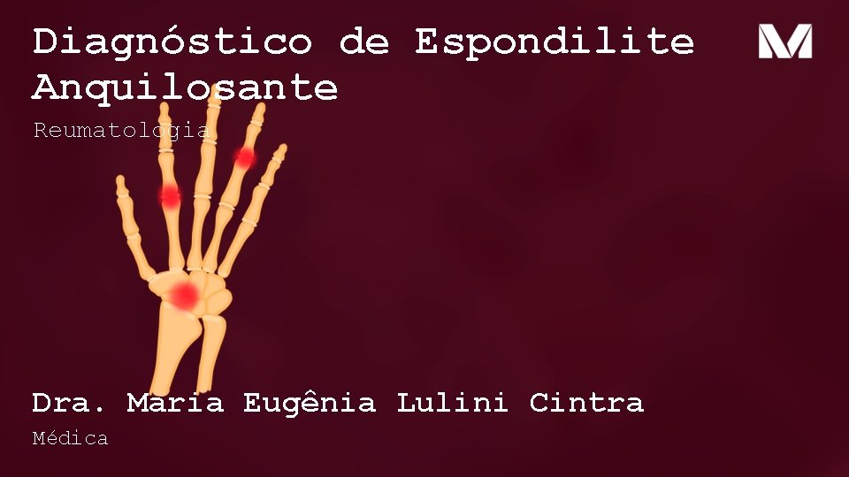 Diagnóstico de Espondilite Anquilosante Reumatologia Dra. Maria Eugênia Lulini Cintra Médica 