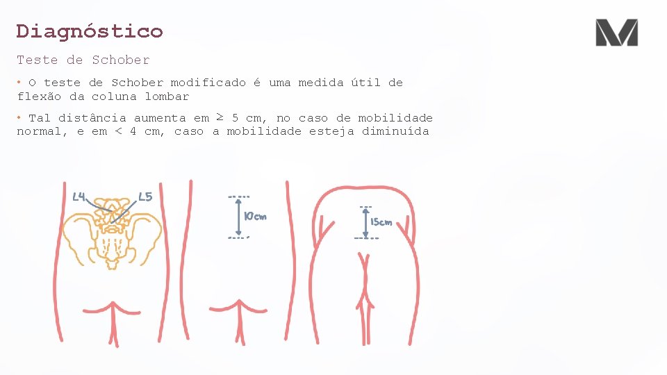 Diagnóstico Teste de Schober • O teste de Schober modificado é uma medida útil