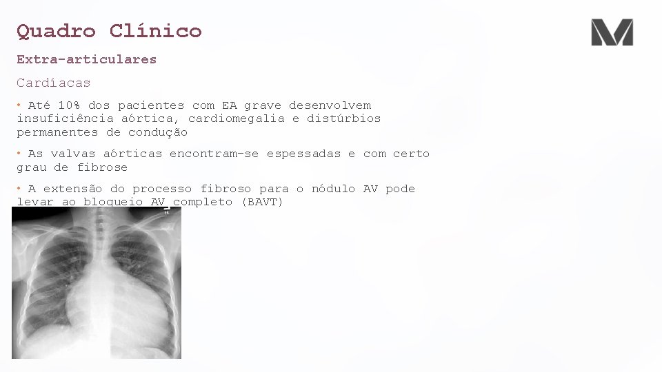 Quadro Clínico Extra-articulares Cardíacas • Até 10% dos pacientes com EA grave desenvolvem insuficiência