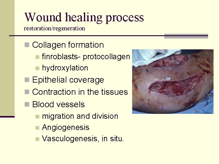 Wound healing process restoration/regeneration n Collagen formation n finroblasts- protocollagen n hydroxylation n Epithelial