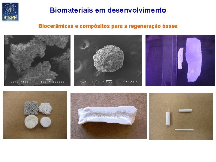 Biomateriais em desenvolvimento Biocerâmicas e compósitos para a regeneração óssea 