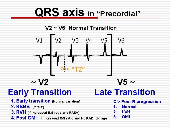 QRS axis in “Precordial” V 2 ~ V 5 Normal Transition V 1 V