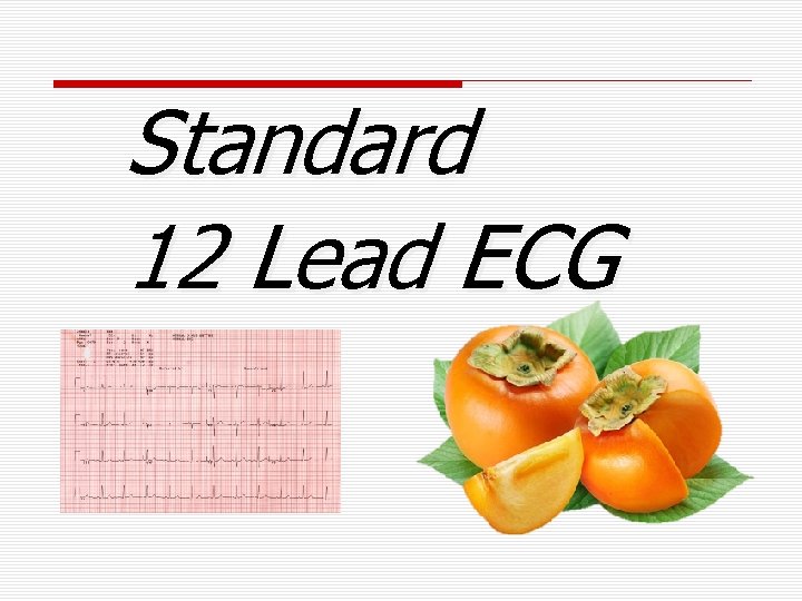 Standard 12 Lead ECG 