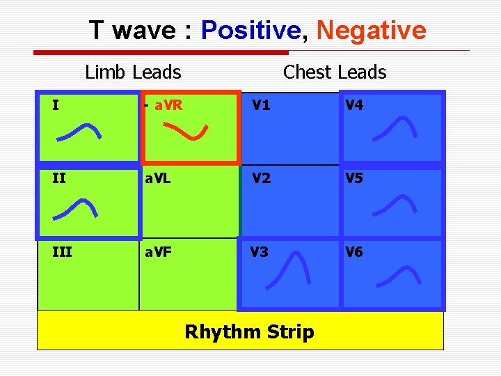 T wave : Positive, Negative Limb Leads Chest Leads I - a. VR V