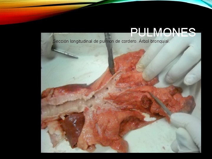 PULMONES Sección longitudinal de pulmón de cordero. Árbol bronquial. 