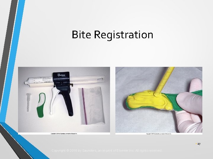 Bite Registration • 27 Copyright © 2016 by Saunders, an imprint of Elsevier Inc.