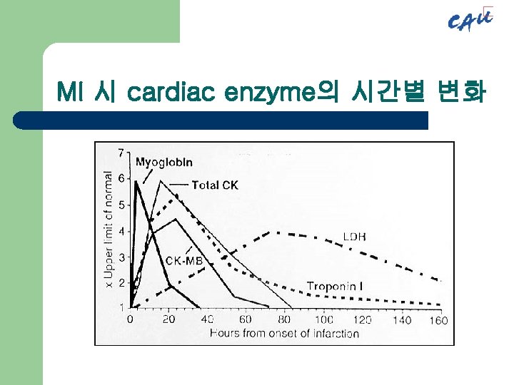 MI 시 cardiac enzyme의 시간별 변화 