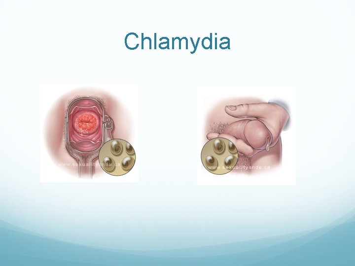 Chlamydia Chlamydia