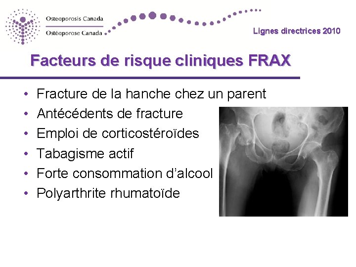 Lignes directrices 2010 Facteurs de risque cliniques FRAX • • • Fracture de la