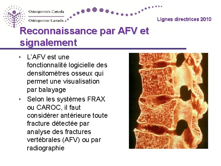 Lignes directrices 2010 Reconnaissance par AFV et signalement • L’AFV est une fonctionnalité logicielle