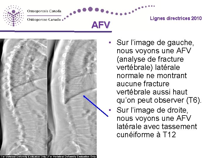 AFV Lignes directrices 2010 • Sur l’image de gauche, nous voyons une AFV (analyse