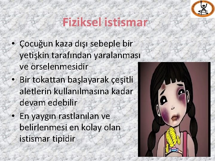 Fiziksel istismar • Çocuğun kaza dışı sebeple bir yetişkin tarafından yaralanması ve örselenmesidir •