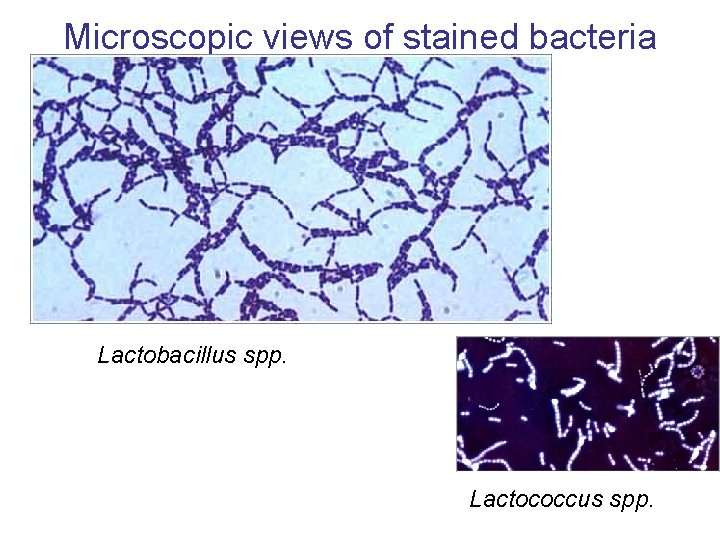 Microscopic views of stained bacteria Lactobacillus spp. Lactococcus spp. 