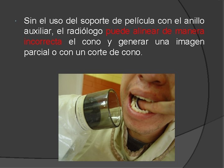  Sin el uso del soporte de película con el anillo auxiliar, el radiólogo