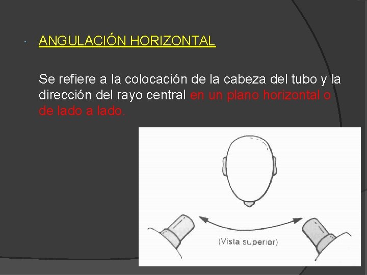  ANGULACIÓN HORIZONTAL Se refiere a la colocación de la cabeza del tubo y